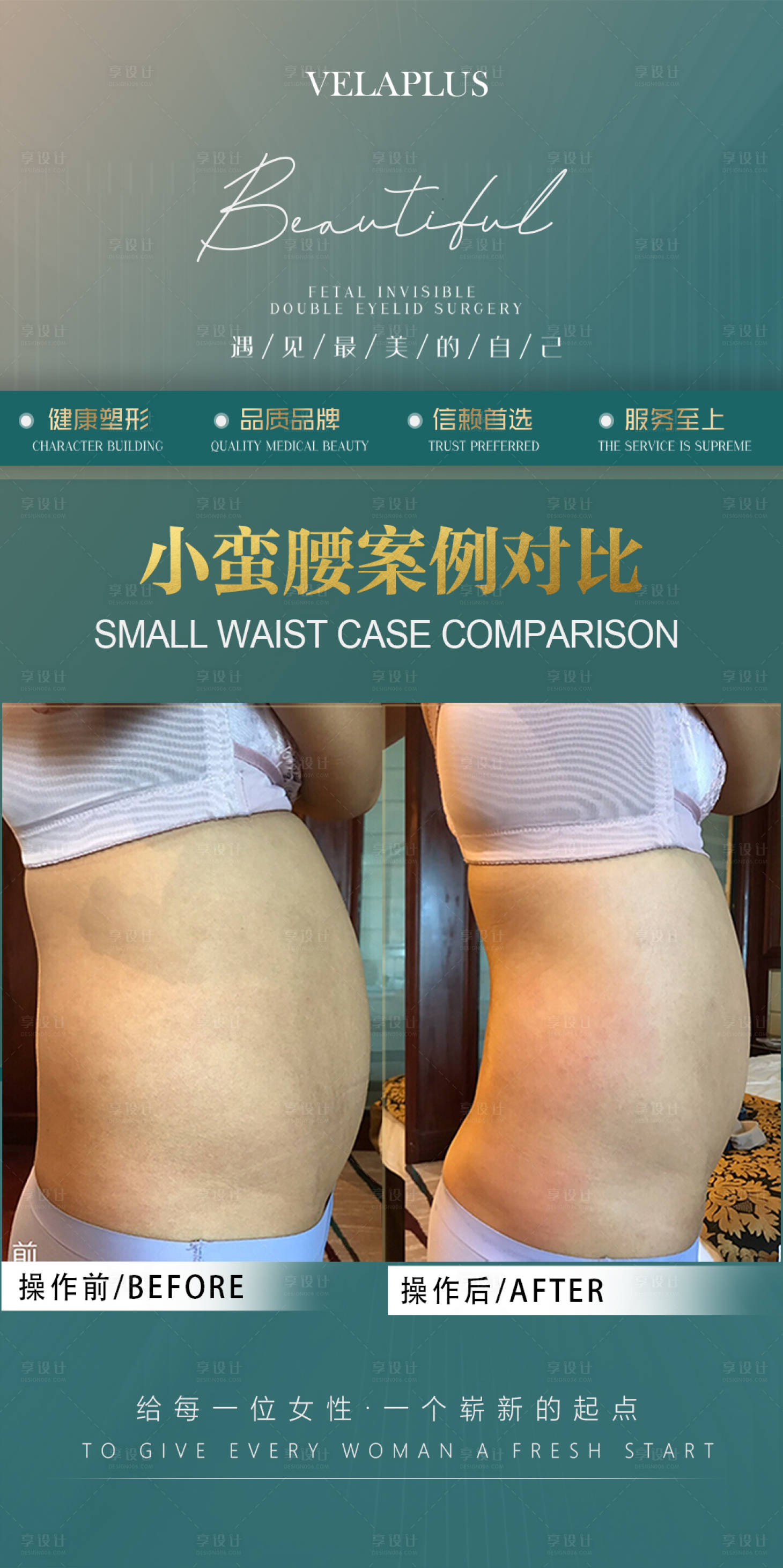 源文件下載【享設(shè)計(jì)】搜索編號(hào)：10640030030653014【醫(yī)美腰腹前后對(duì)比海報(bào)】