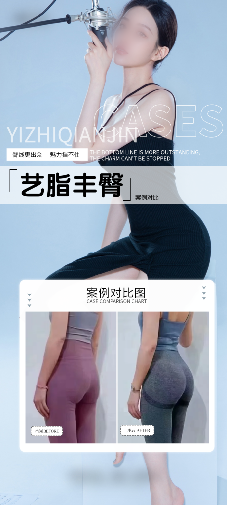 医美丰臀案例海报