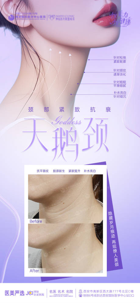 源文件下载【天鹅颈海报】编号：30780030191551059