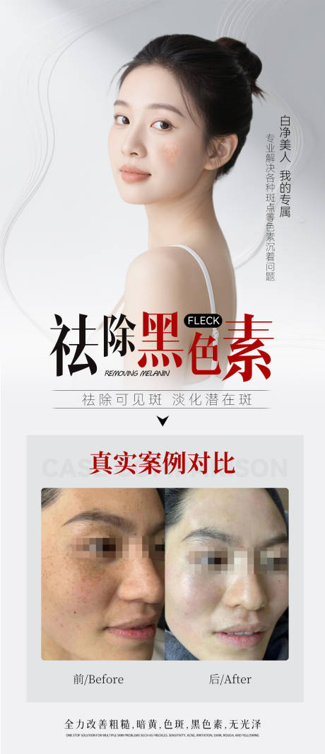 源文件下載【享設計】搜索編號：40260029947541689【祛斑對比海報】