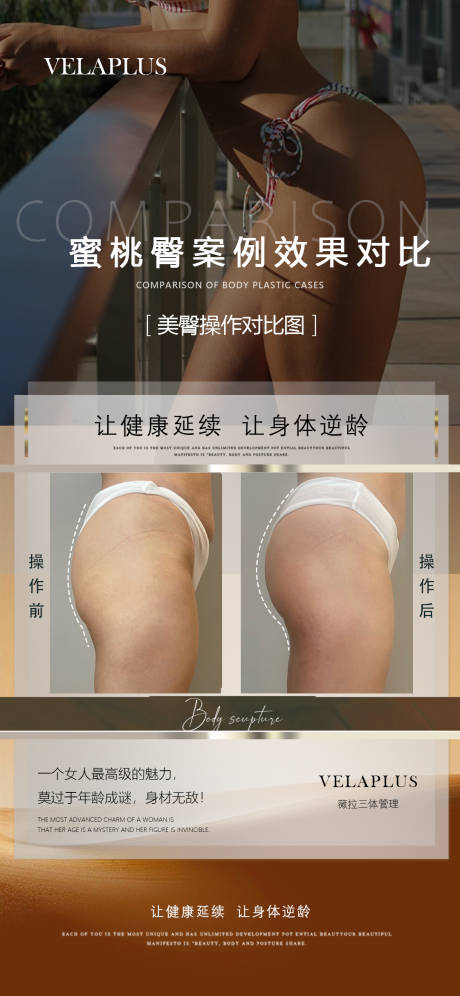 医美臀部前后对比海报