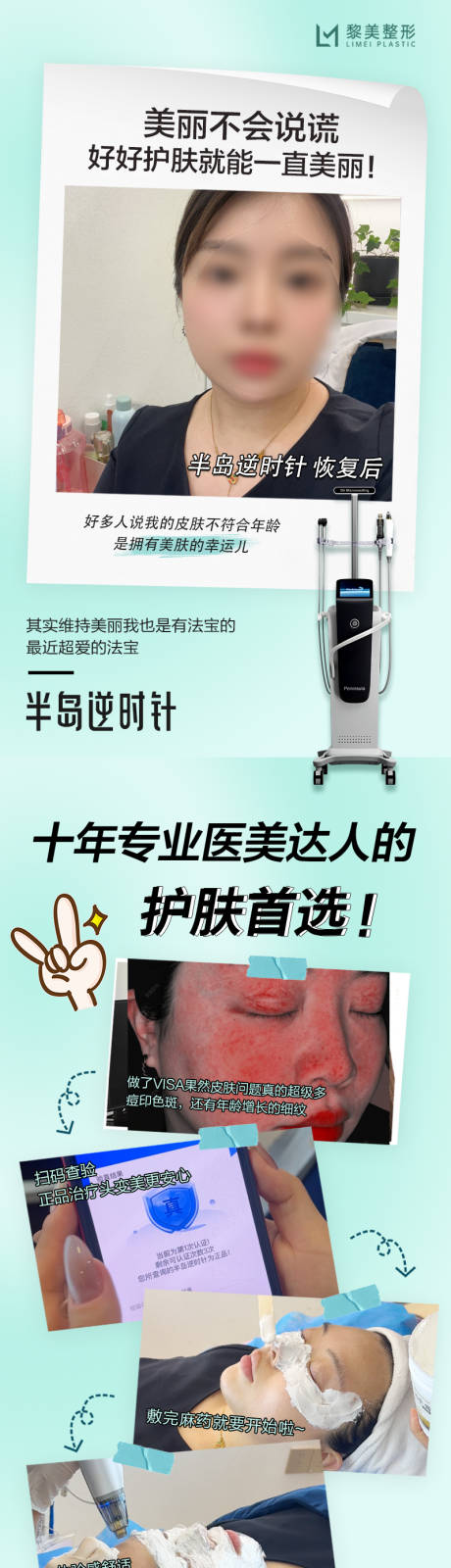 源文件下载【黄金微针案例】编号：77620030330584270