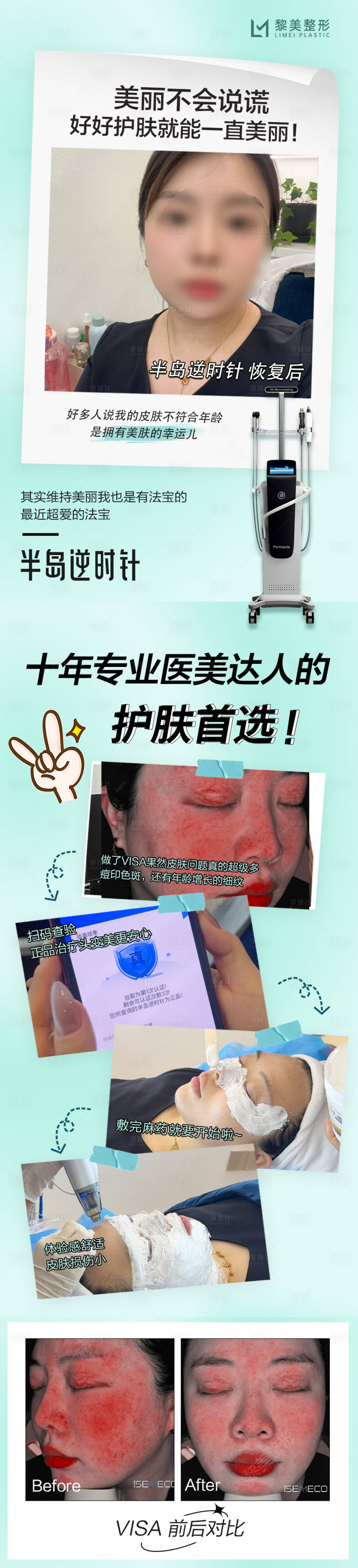 源文件下载【享设计】搜索编号：77620030330584270【黄金微针案例】