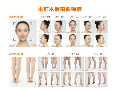 源文件下載【享設計】搜索編號：47390030286538364【醫美案例拍照標準】