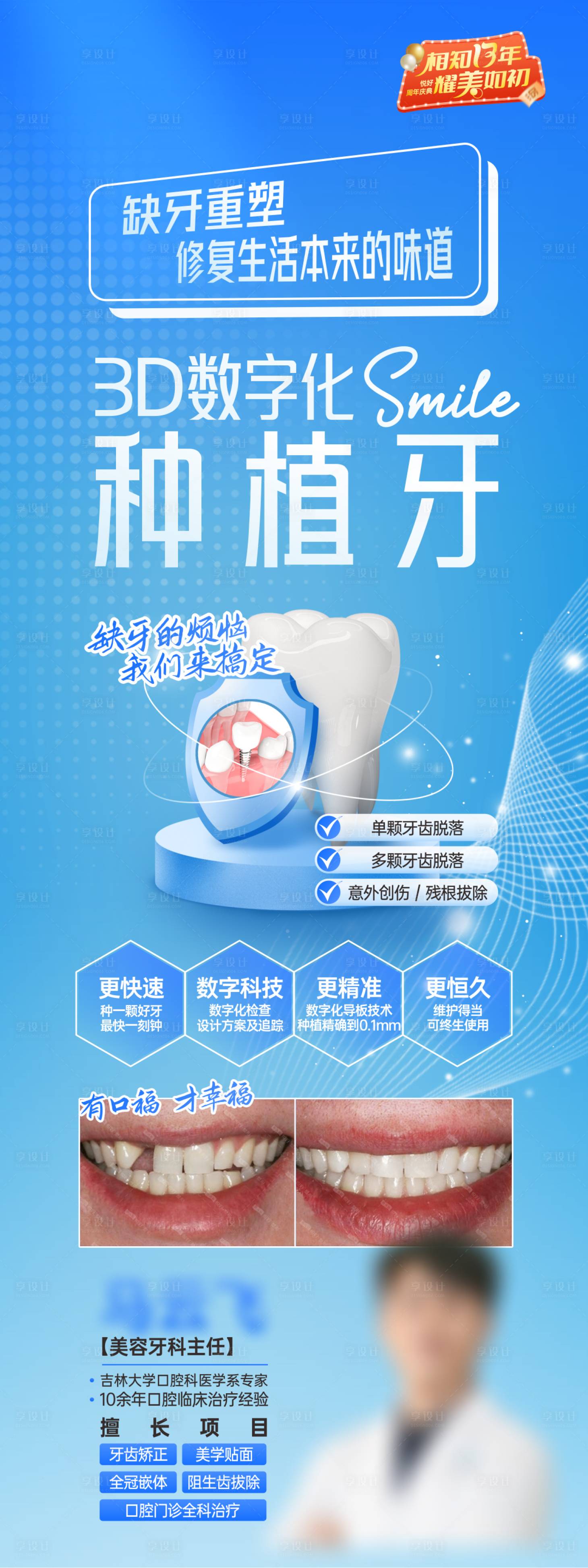 源文件下載【享設(shè)計(jì)】搜索編號(hào)：75640029913959768【3D數(shù)字化種植牙長(zhǎng)圖】