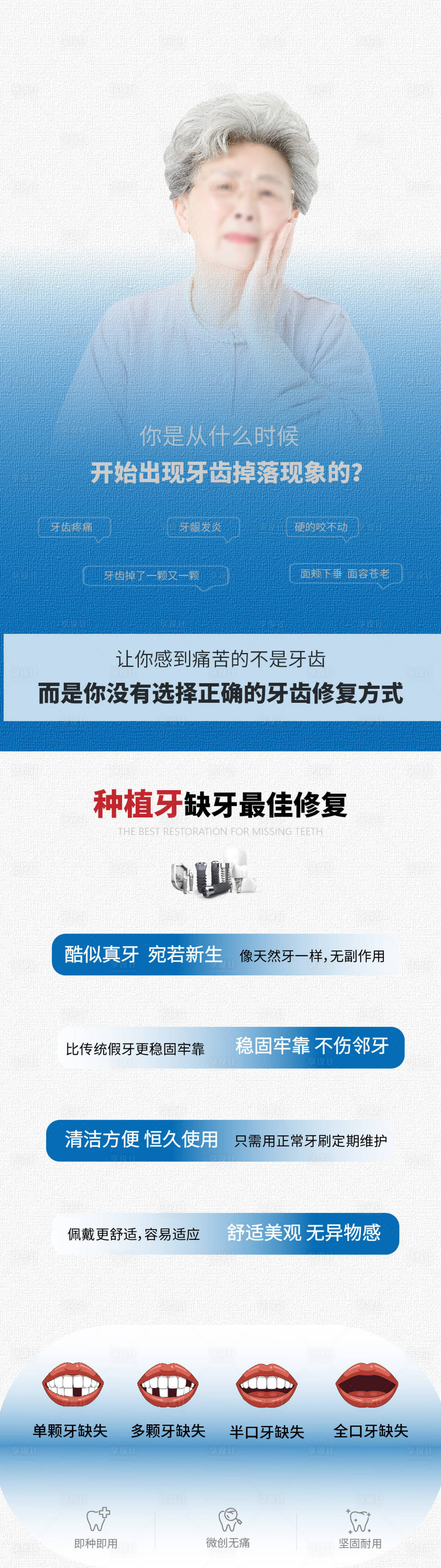 源文件下载【口腔医院种植牙优势品宣海报】编号：59710029961455293