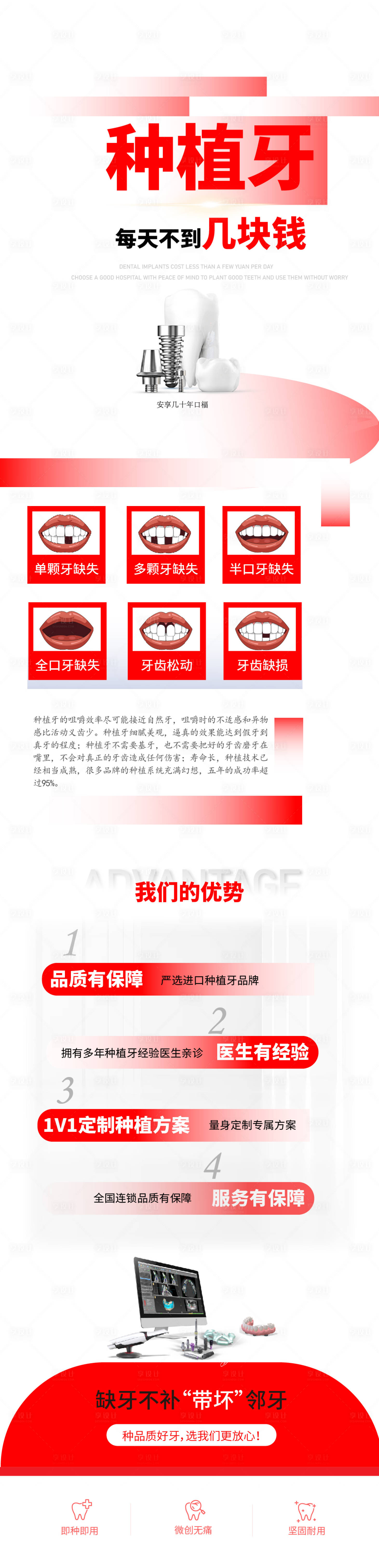 源文件下載【享設計】搜索編號：60340030372076960【口腔種植牙品宣海報】