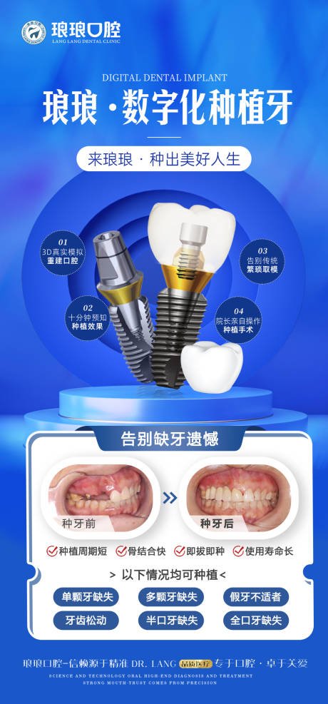 源文件下载【享设计】搜索编号：56880029959934600【数字化种植牙海报】