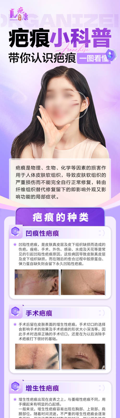 源文件下载【疤痕科普详情页】编号：12270030053011534