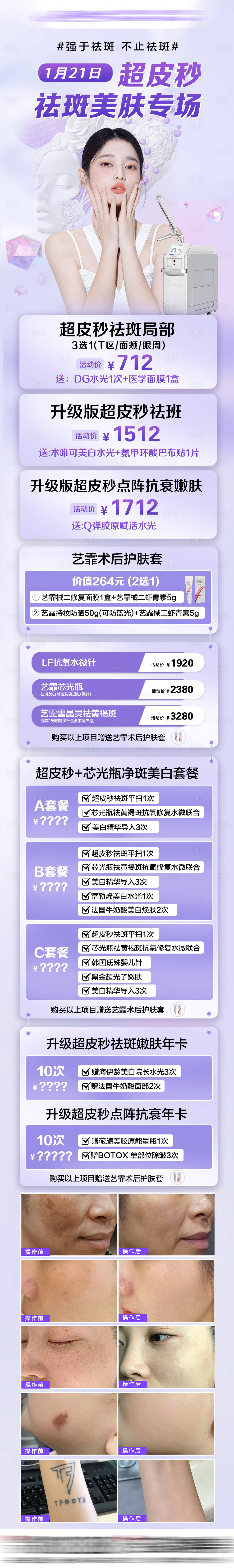 源文件下載【享設計】搜索編號：69450030351401711【醫美超皮秒祛斑】
