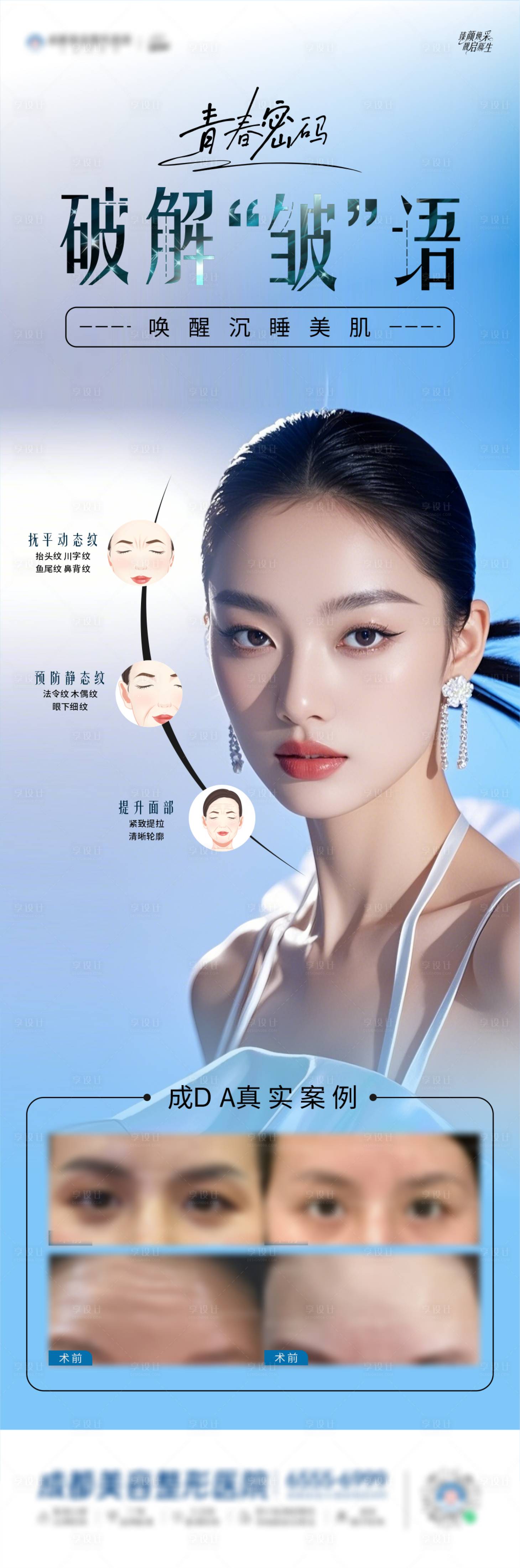 源文件下载【享设计】搜索编号：70160030196529625【肉毒素除皱海报】