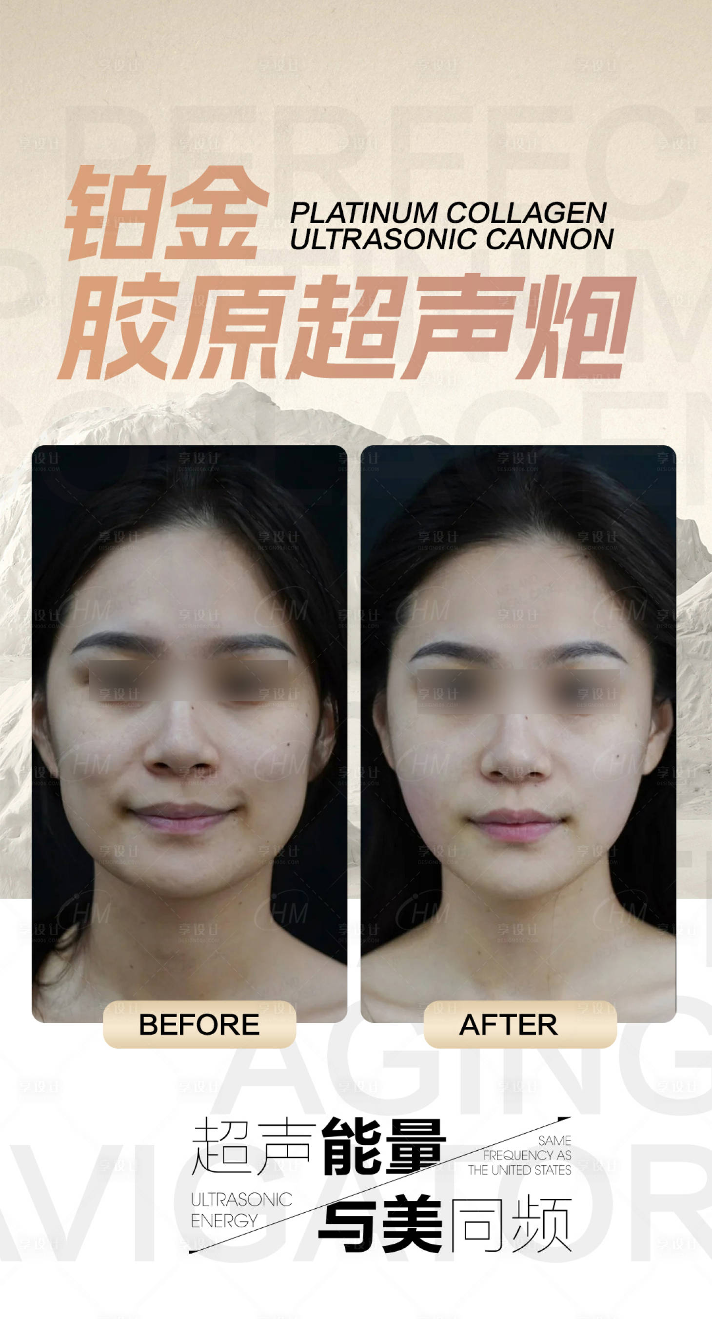 源文件下載【享設(shè)計(jì)】搜索編號：64860030011078310【鉑金超聲炮案例宣傳海報(bào)】