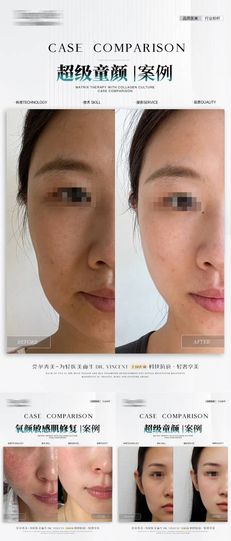 源文件下载【医美童颜敏感肌案例】编号：59850030450163916