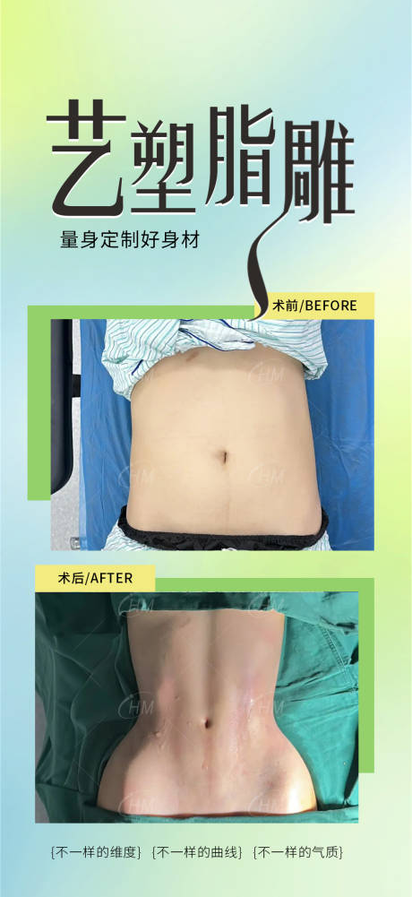 源文件下载【医美艺塑脂雕海报】编号：32130030084129775
