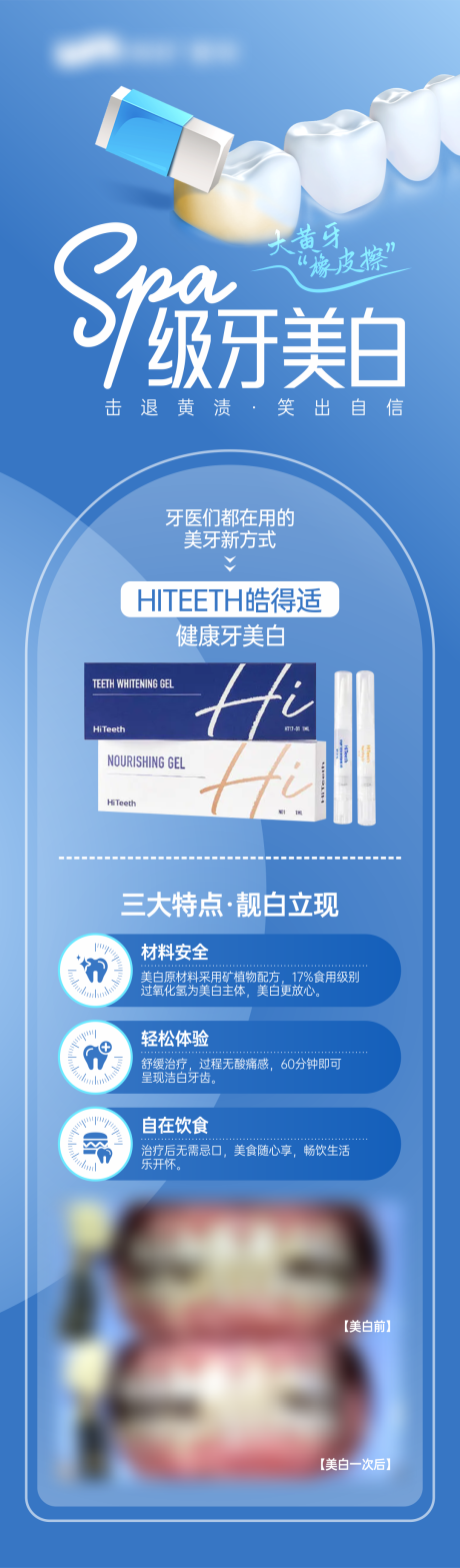 源文件下载【享设计】搜索编号：99990029916713550【美白牙齿 】