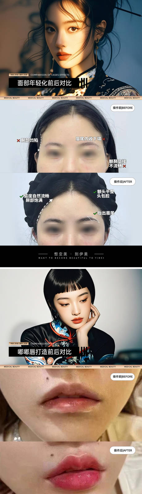 医美案例对比模板