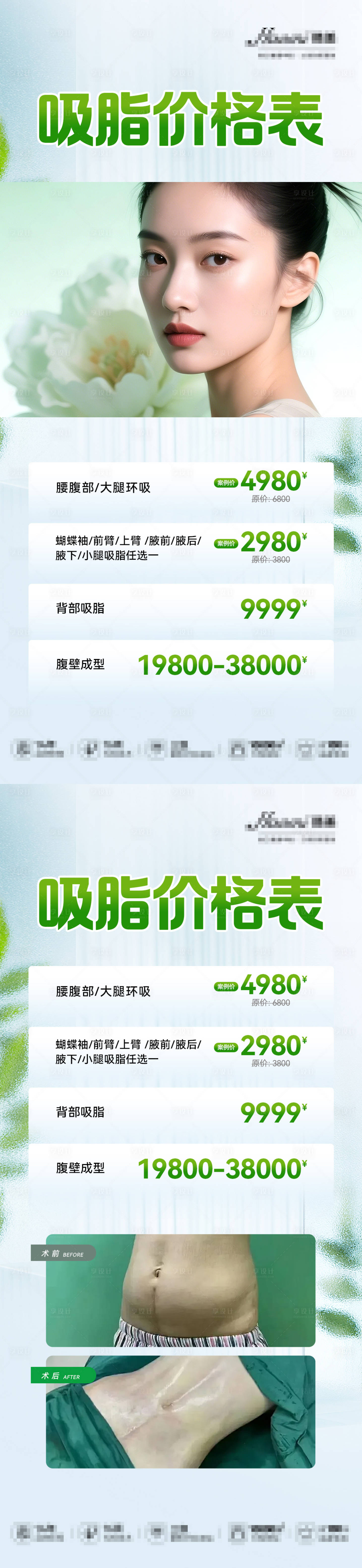 源文件下載【享設計】搜索編號：89440030132652929【醫美吸脂項目價格海報】