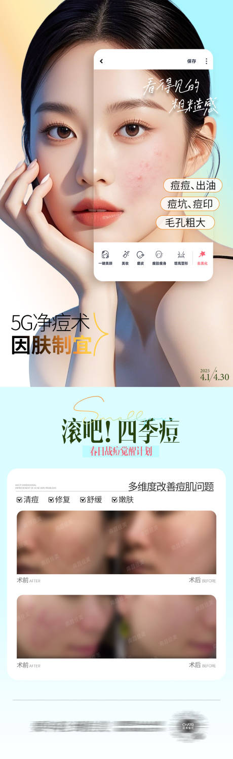 源文件下载【祛痘】编号：77580030074044517