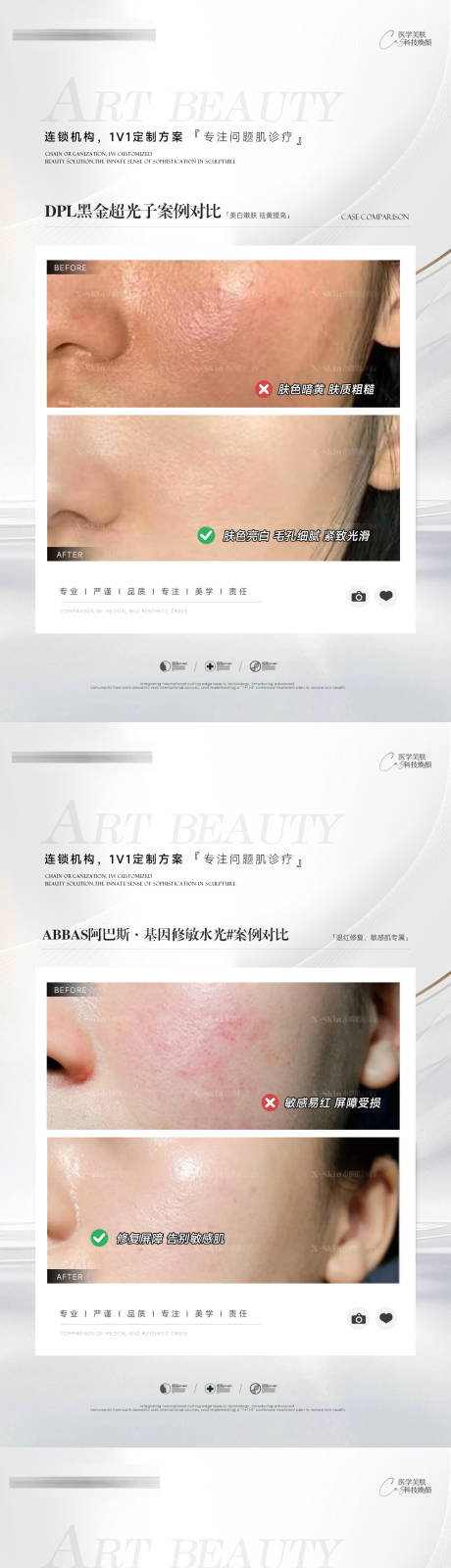 源文件下载【医美案例对比系列海报】编号：76150030430638723