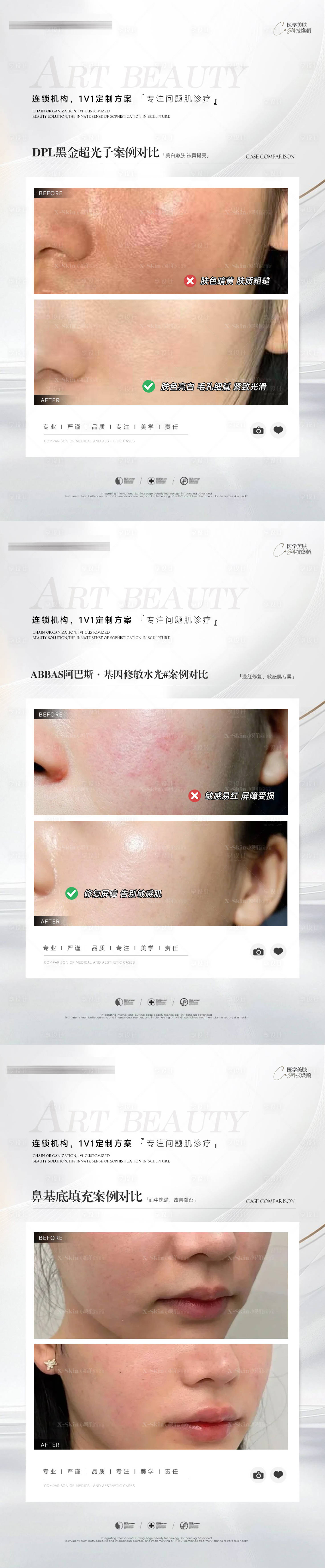 源文件下載【享設(shè)計(jì)】搜索編號(hào)：76150030430638723【醫(yī)美案例對(duì)比系列海報(bào)】