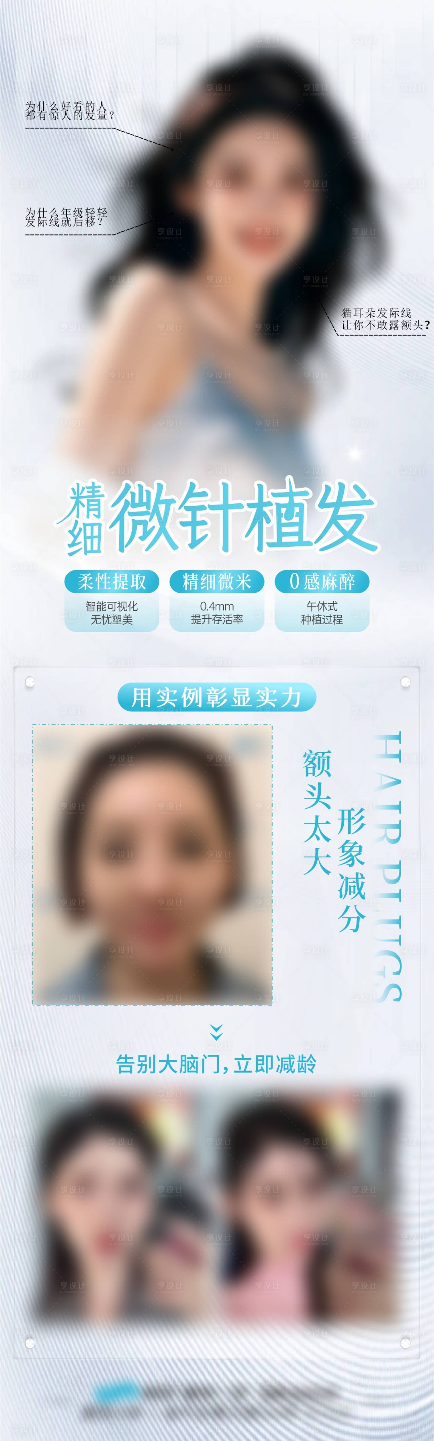 源文件下載【享設計】搜索編號：71410030111471238【微針植發】