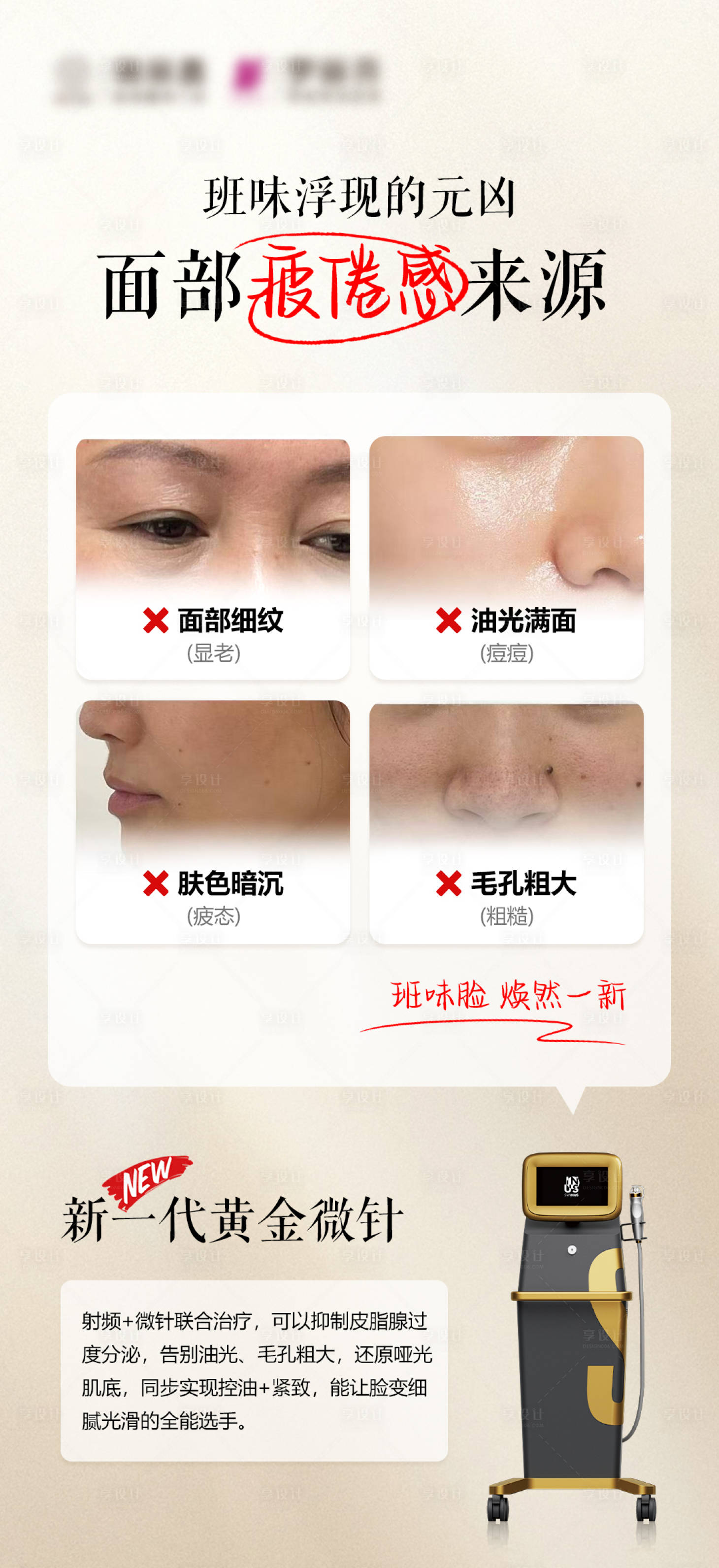 源文件下载【享设计】搜索编号：26480030204139639【黄金微针海报】