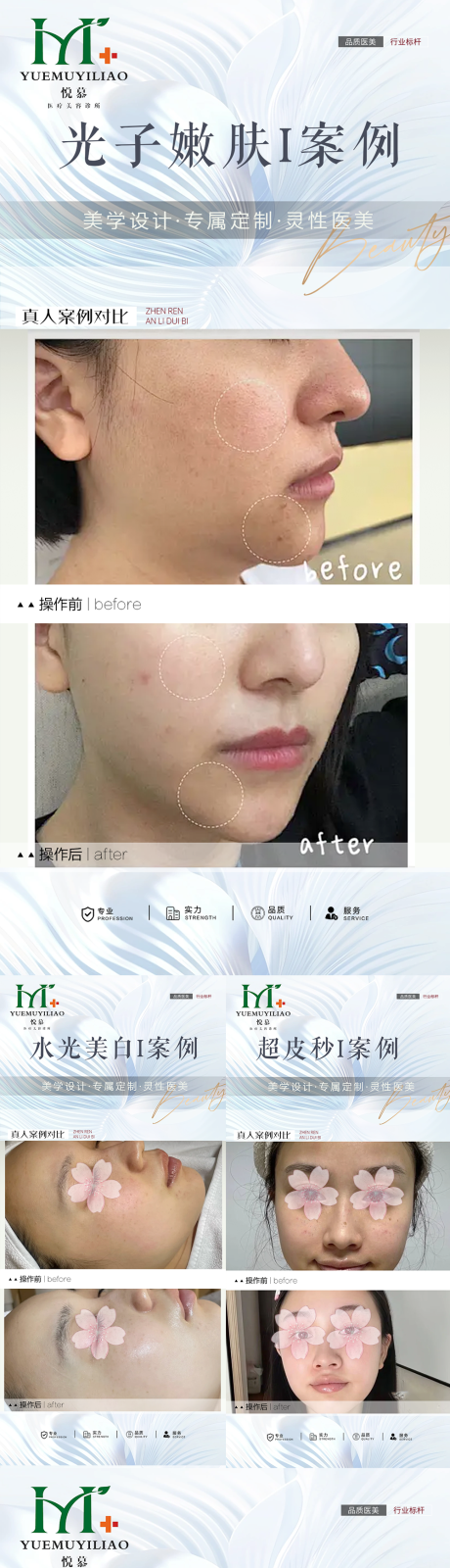 源文件下载【整形案例】编号：77400030272606988