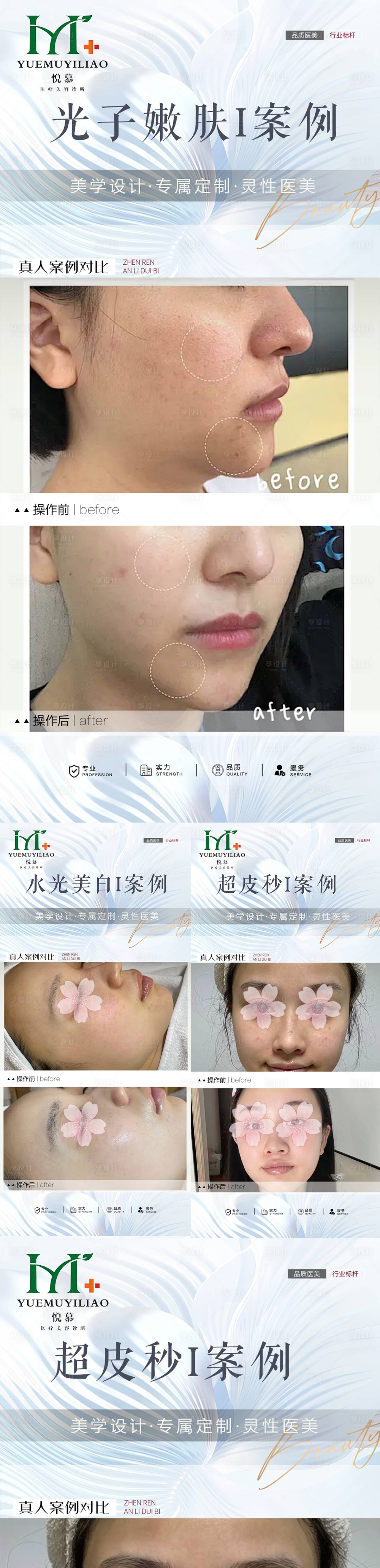 源文件下載【享設計】搜索編號：77400030272606988【整形案例】