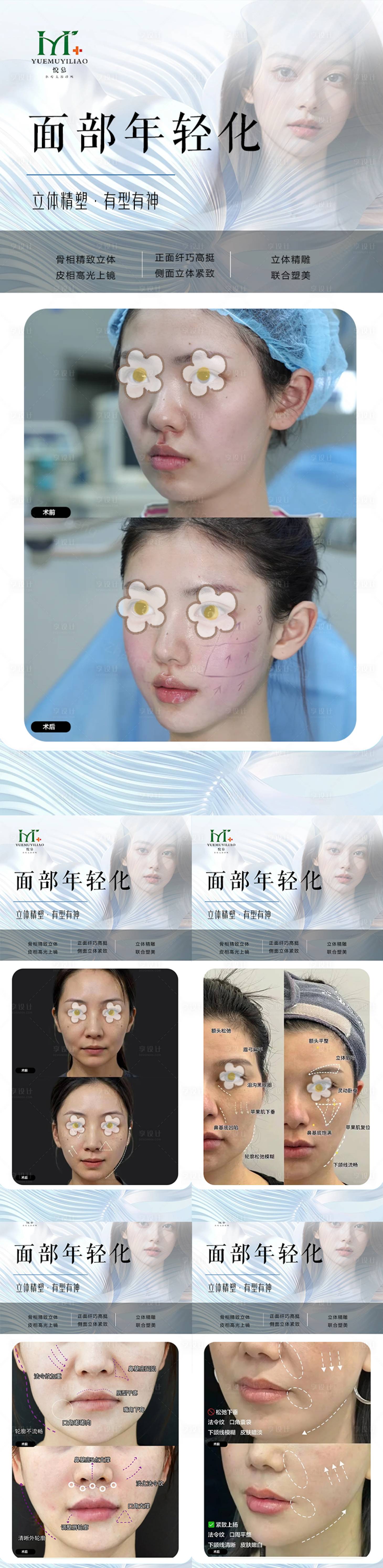 源文件下載【享設(shè)計(jì)】搜索編號(hào)：26780030326927856【整形案例海報(bào)】