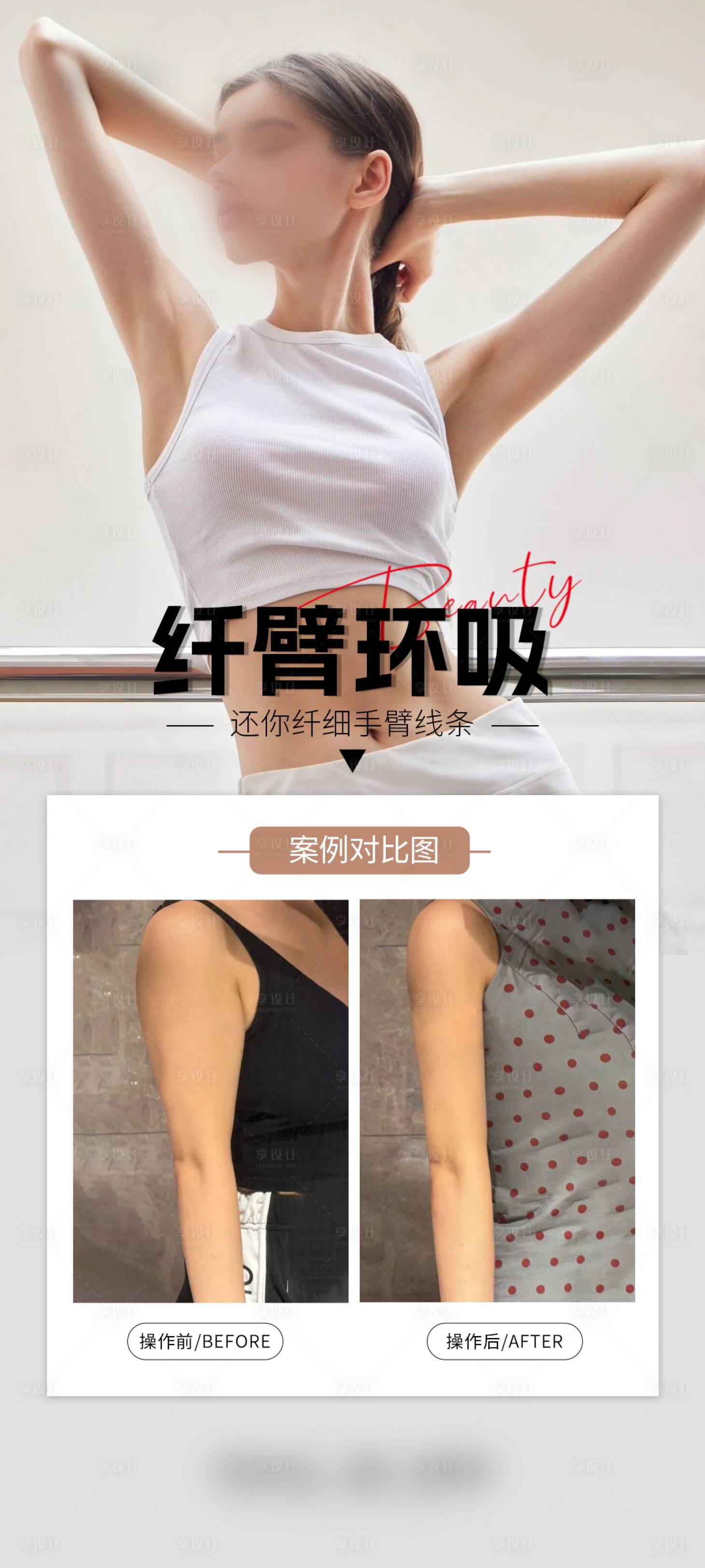 源文件下载【医美手臂案例海报】编号：62020029922998906