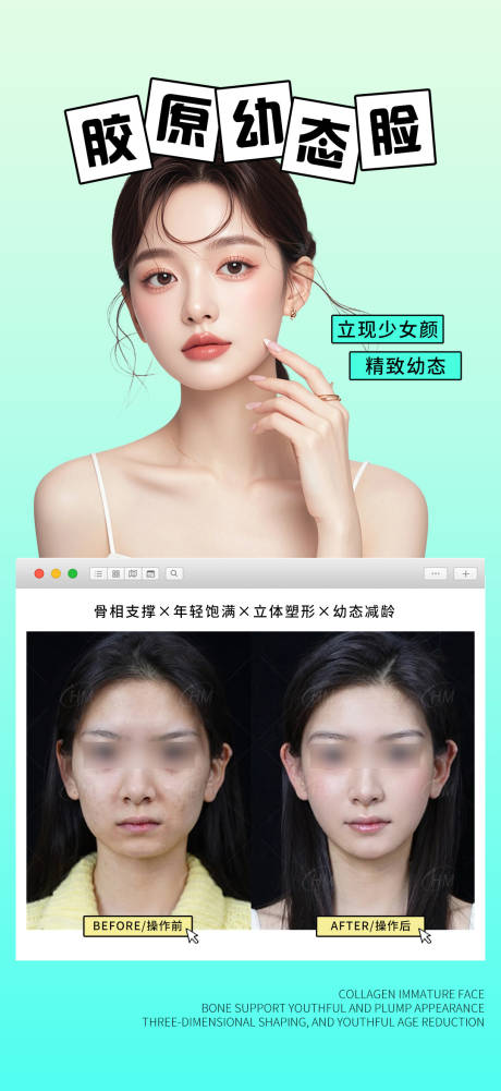 源文件下載【享設計】搜索編號：21830030105299138【膠原幼態臉案例】