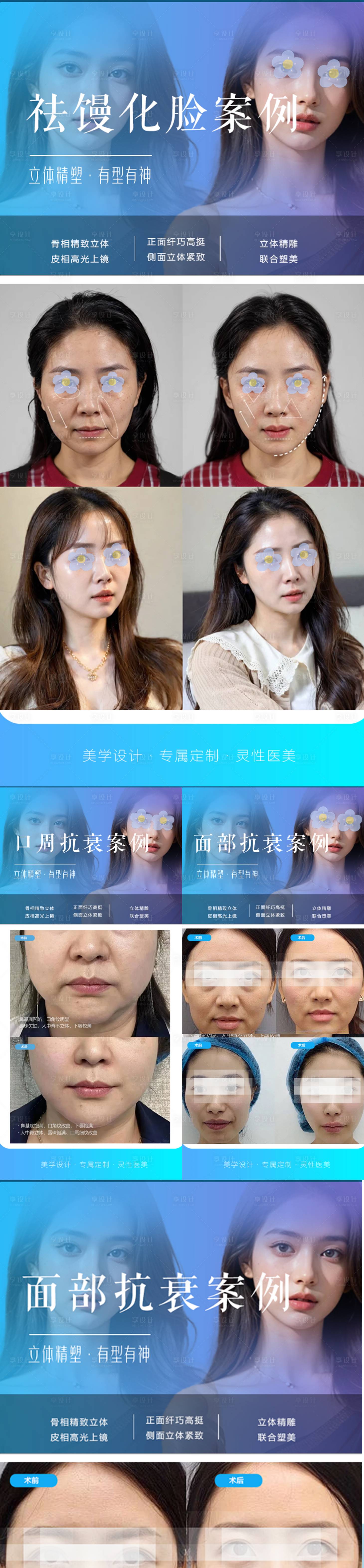 源文件下载【享设计】搜索编号：32140030497261689【整形案例】