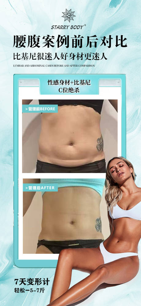 医美腰腹前后对比海报