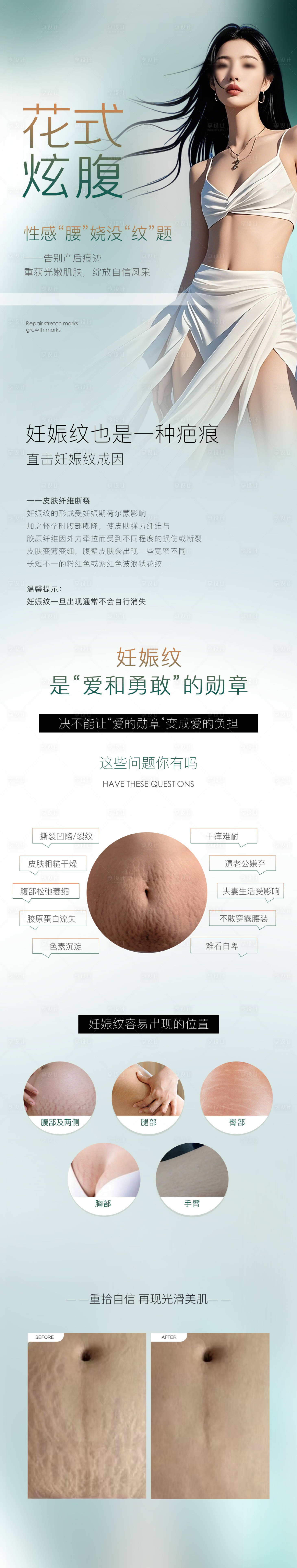 源文件下载【妊娠纹修复海报】编号：48410030431641602