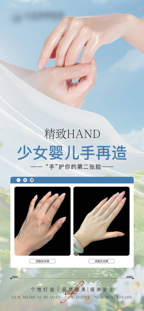 源文件下载【少女婴儿手再造案例对比海报】编号：51520030371993390