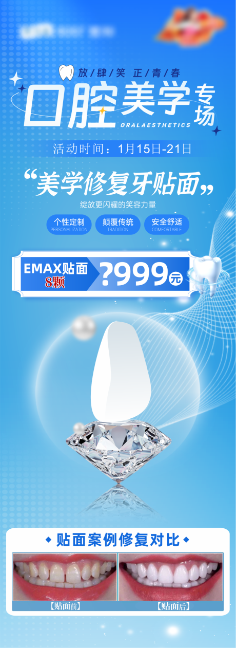 源文件下載【口腔美學牙貼面長圖】編號：73740029914047083