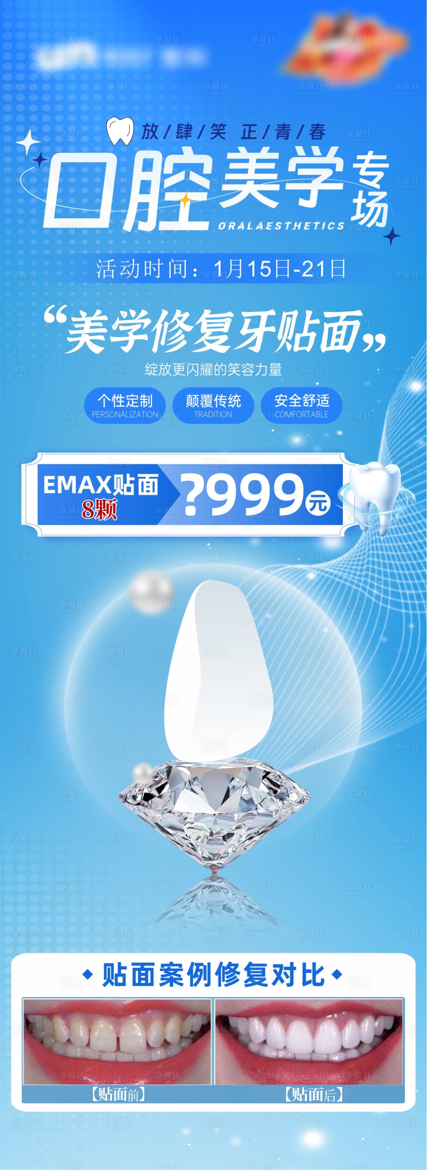 源文件下载【享设计】搜索编号：73740029914047083【口腔美学牙贴面长图】