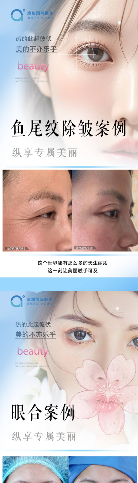 源文件下载【整形案例】编号：70390030118851096