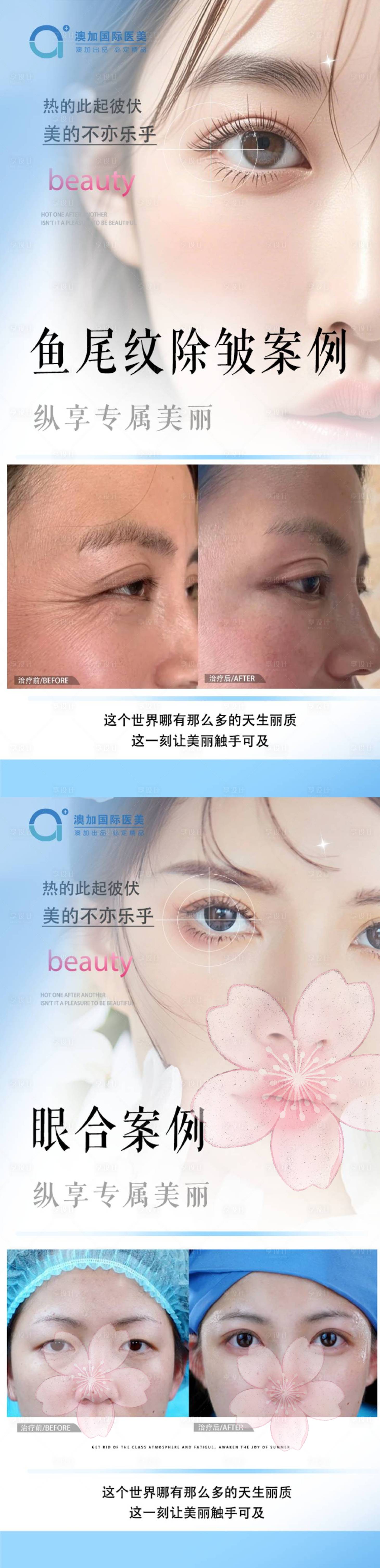 源文件下载【整形案例】编号：70390030118851096