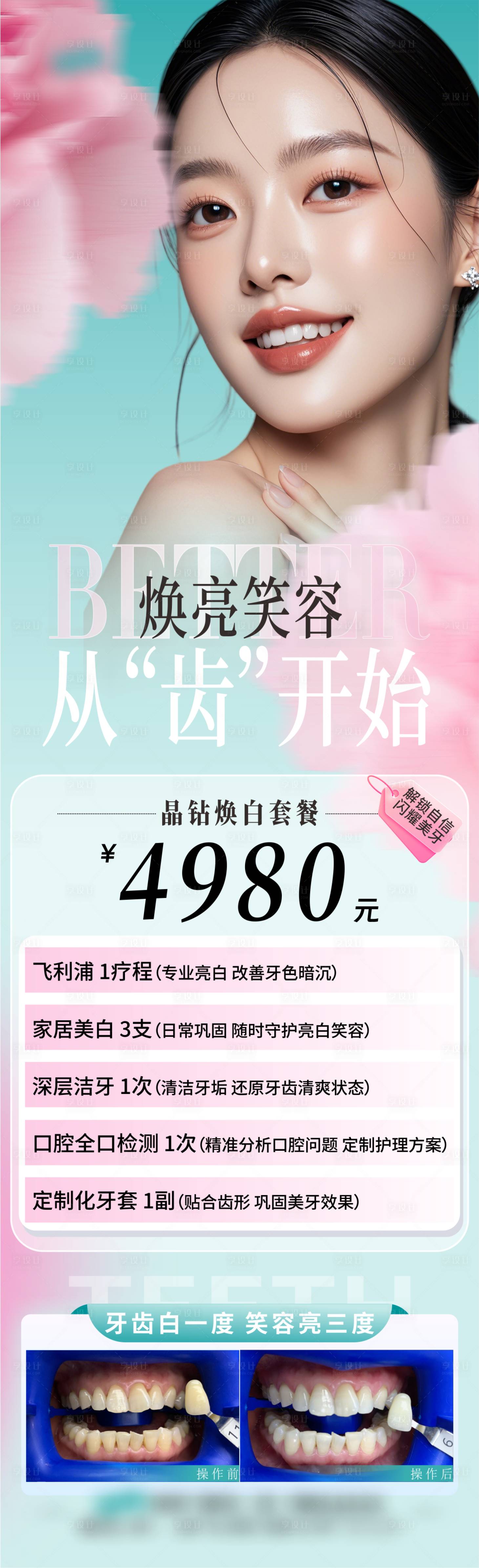 源文件下載【口腔煥亮笑容長圖】編號：47260029913982255