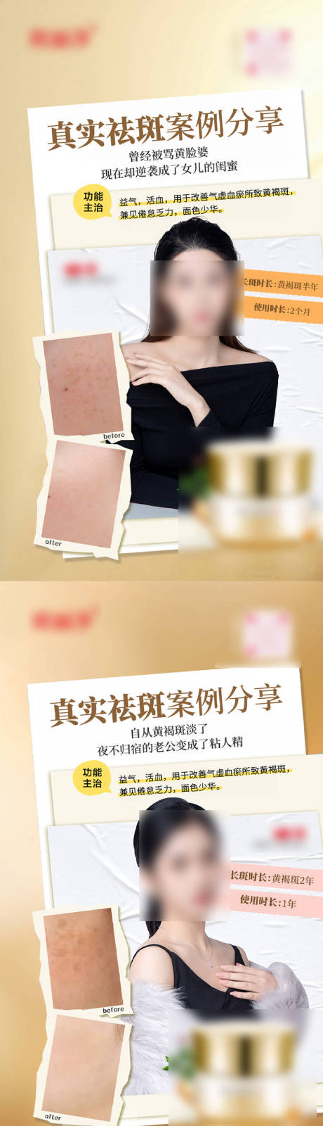 源文件下載【享設計】搜索編號：39300030102685091【祛斑海報】