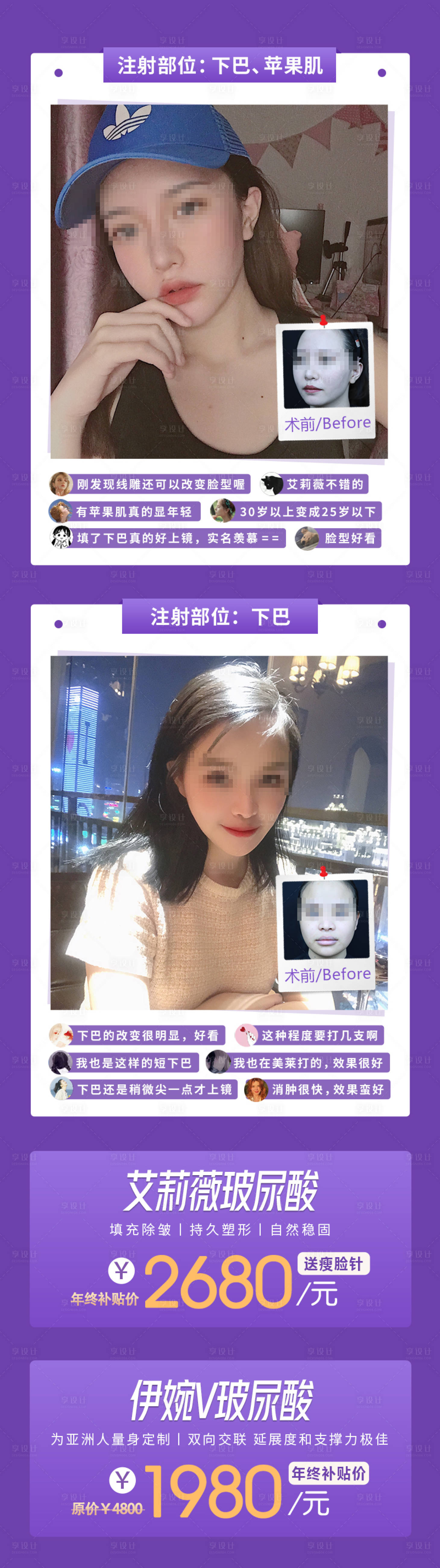 源文件下载【享设计】搜索编号：48710030405213917【医美注射抗衰玻尿酸案例对比海报】