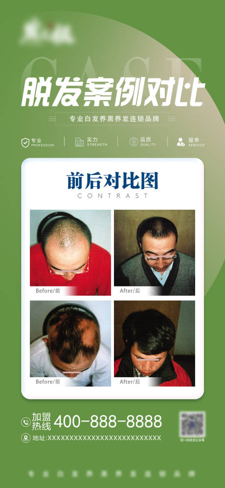 源文件下載【醫美脫發案例對比海報】編號：14760029919524762