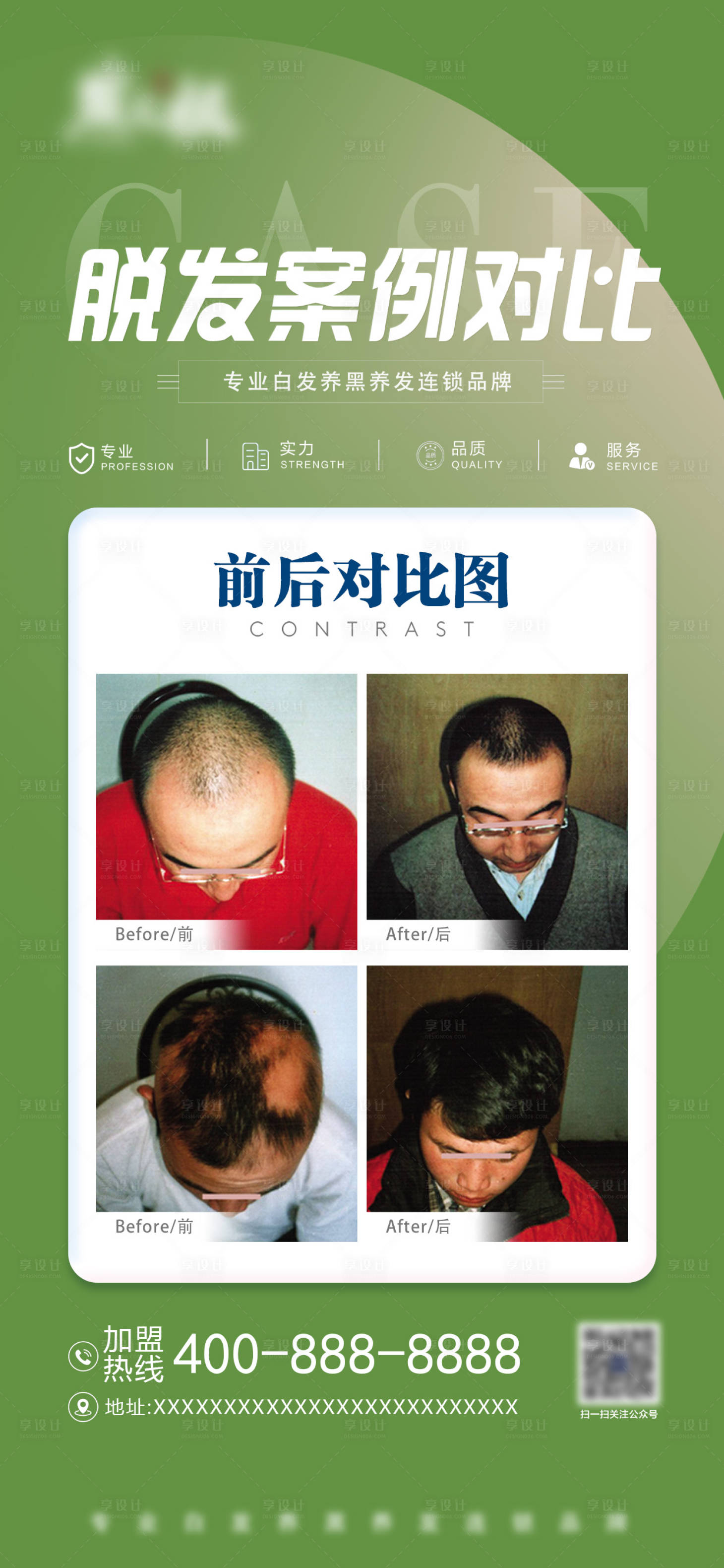 源文件下载【享设计】搜索编号：14760029919524762【医美脱发案例对比海报】