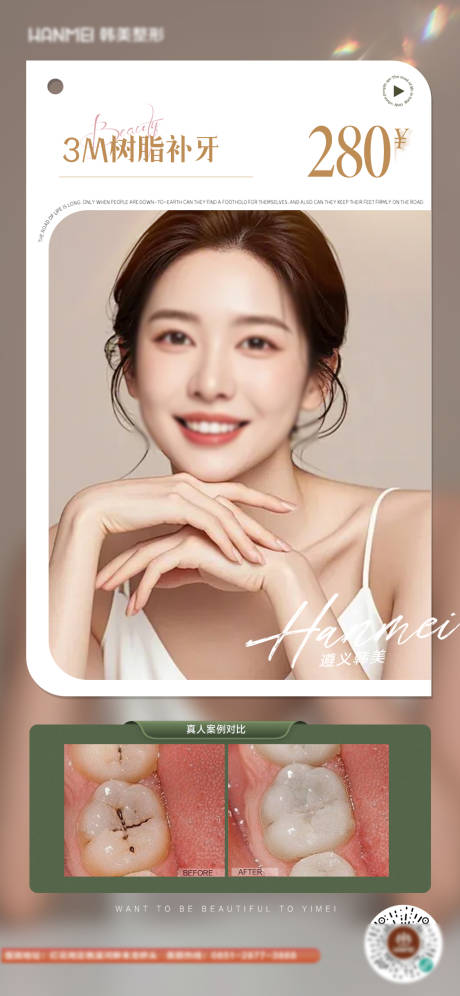 医美口腔树脂补牙海报
