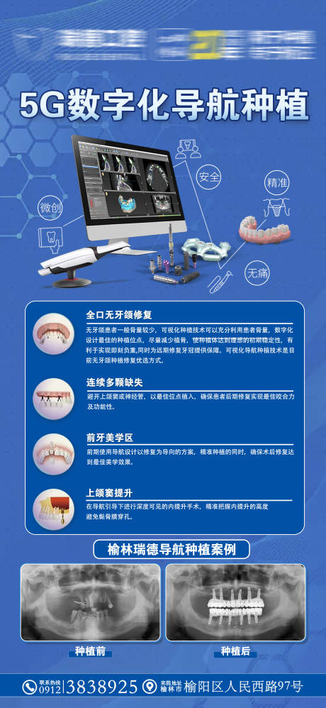 源文件下載【享設計】搜索編號：52930030136721968【導航種植/種植種植案例】
