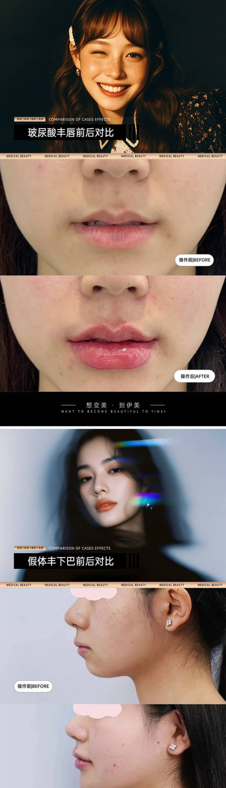 源文件下载【医美案例对比模板】编号：40210030438346574