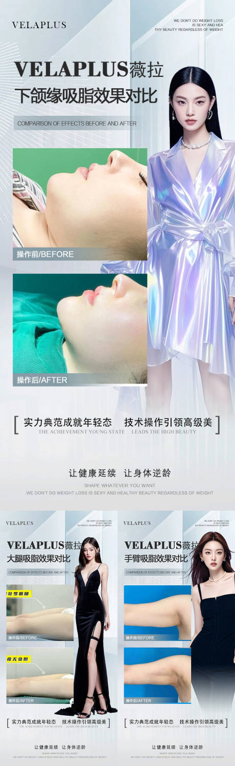 源文件下载【大腿下颌缘手臂吸脂案例海报】编号：24070030373711931