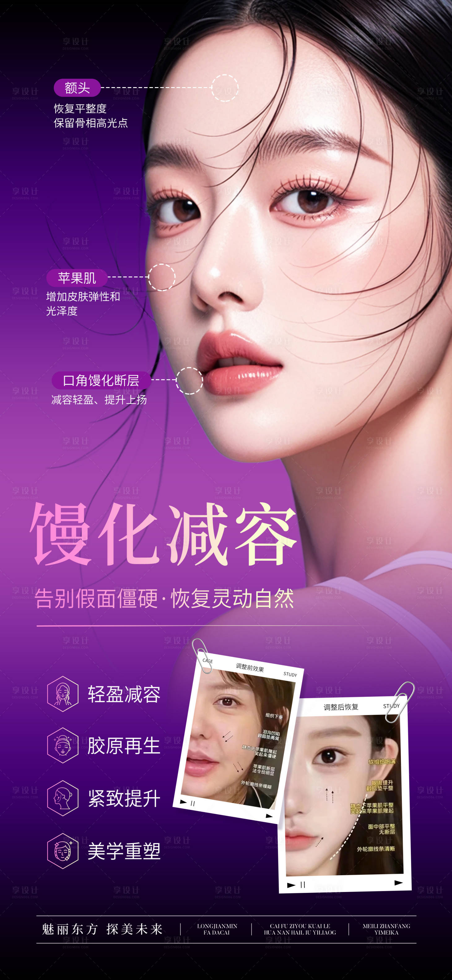 源文件下载【医美面部馒化减容对比图海报】编号：16670029991411596