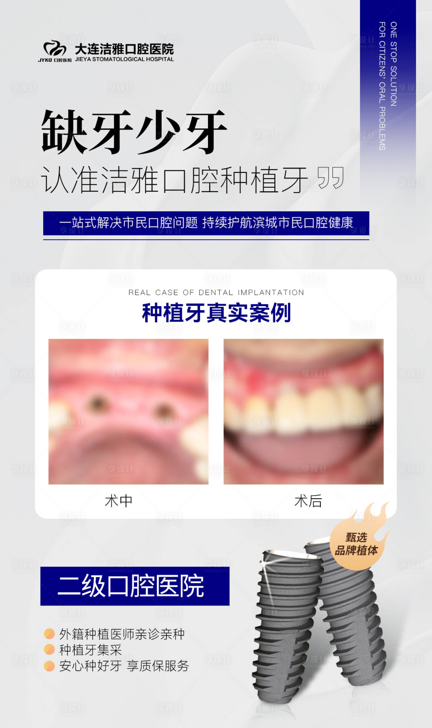 源文件下載【享設計】搜索編號：23120030328796859【口腔種植牙案例對比海報】